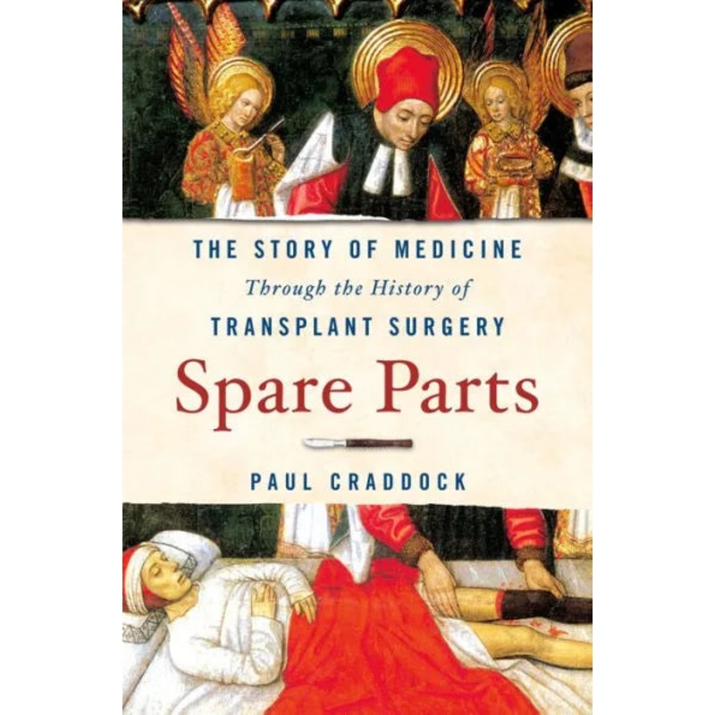 Spare Parts: The Story of Medicine Through the History of Transplant Surgery Paperback